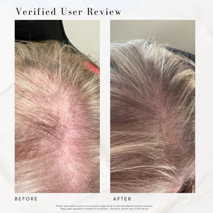 Power Fol Advanced Multi-Correctional Scalp and Hair Treatment (50ml)