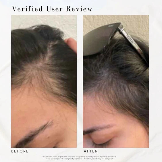 Power Fol Advanced Multi-Correctional Scalp and Hair Treatment (50ml)