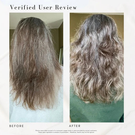Power Fol Advanced Scalp And Hair Treatment Shampoo (266ml)